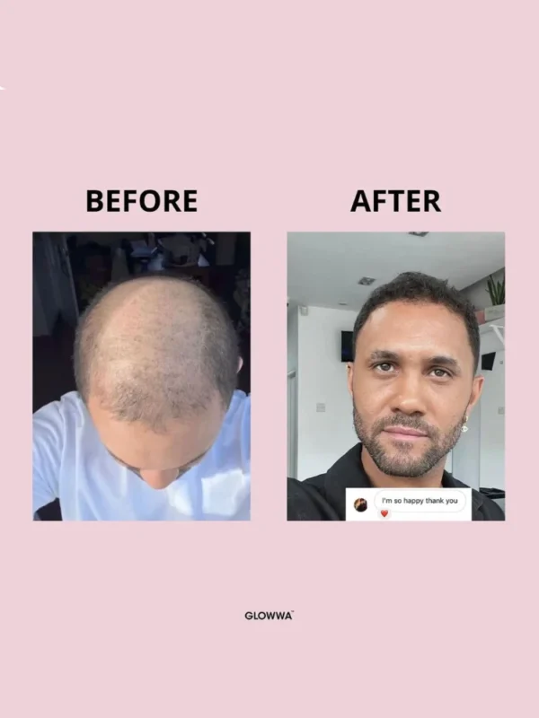 Hair growth transformation before and after using product.