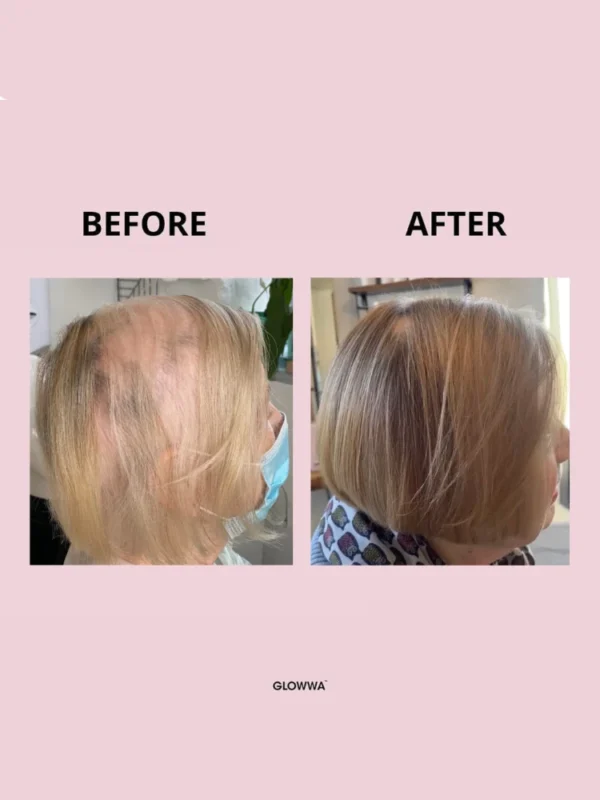 Hair transformation: before and after hair treatment