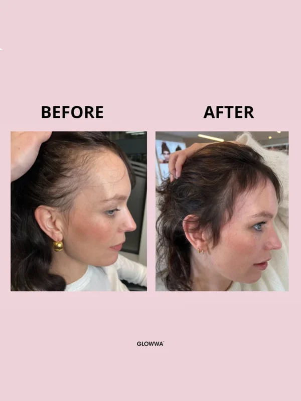 Hair growth treatment before and after comparison